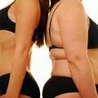 Sovrappeso e Obesità